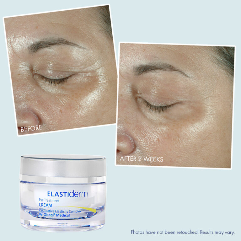 Obagi ELASTIderm® Eye Cream – Before & After